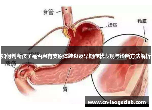 如何判断孩子是否患有支原体肺炎及早期症状表现与诊断方法解析